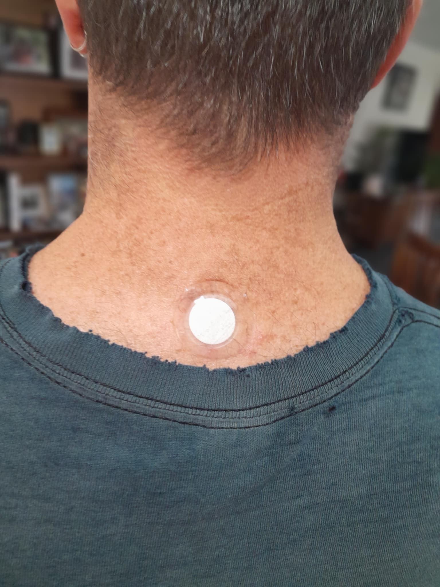 X39 patch placement on back of neck for consistent daily use