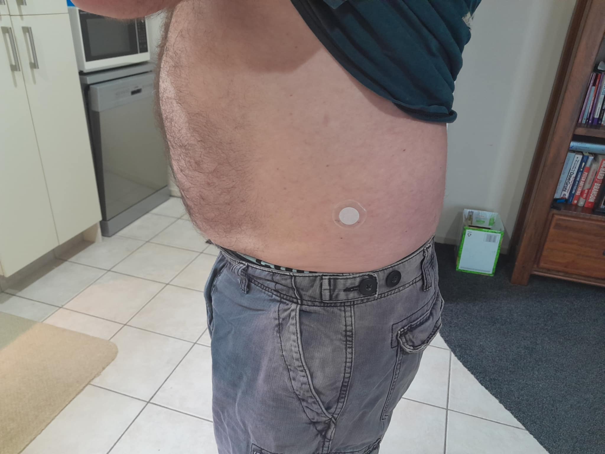 X39 patch placement on lower abdomen or hip area for daily routine