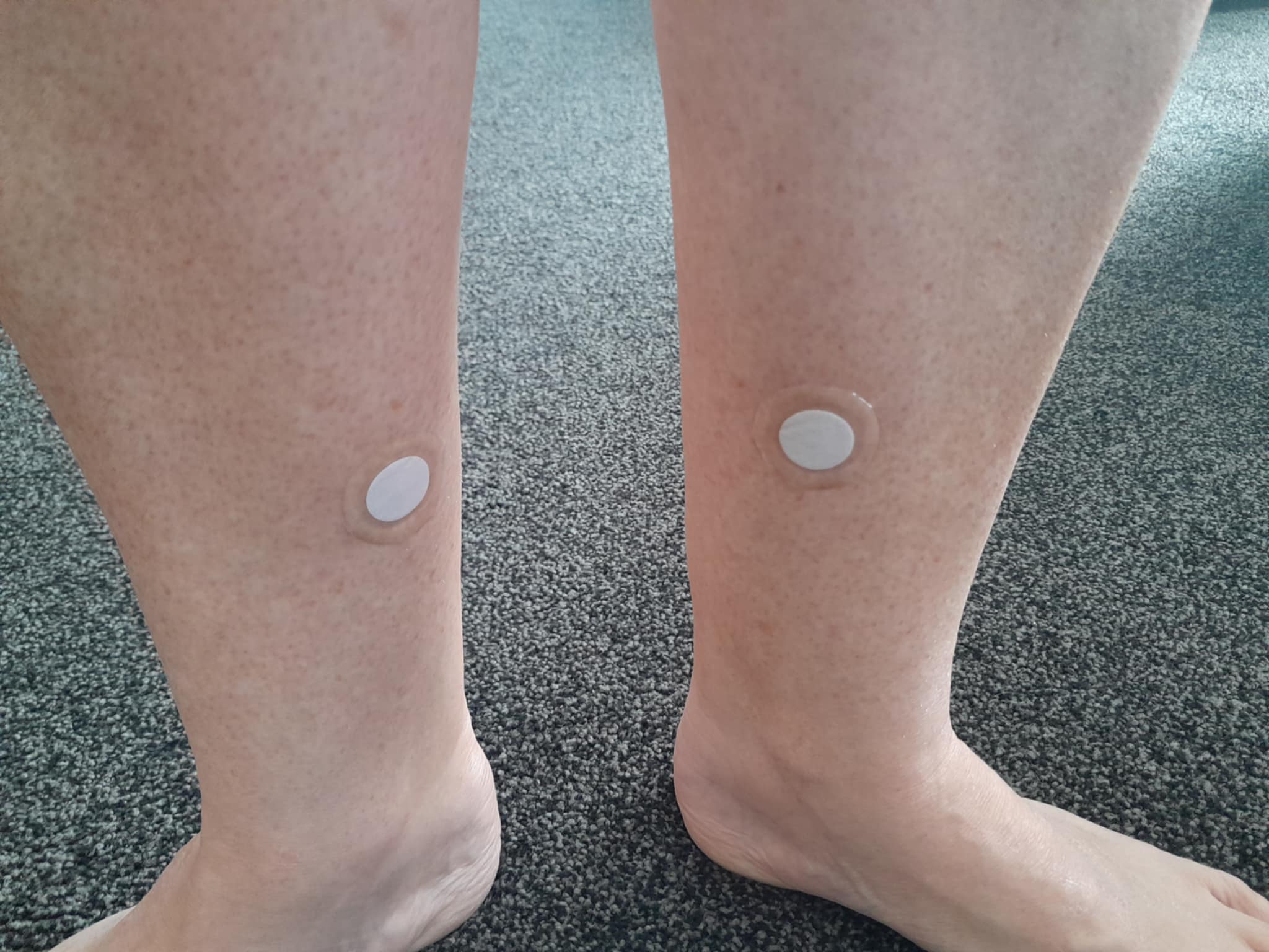 patches worn on lower legs as an example of a low-body placement option