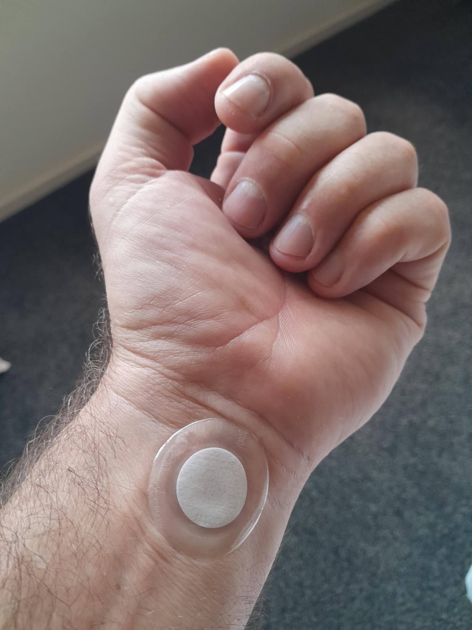 patch worn on inner wrist area as a practical example location